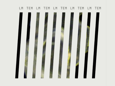 Alternating vertical strips of light-microscope and transmission electron microscope sections, labelled LM and TEM.